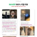 #부평필러 와이랩 성형외과의원 이마필러, 입술필러, 인모드 후기
