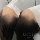 이미지헤어라인 이미지