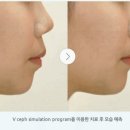 우리미소치과의원 네이버블로그