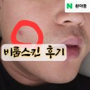 비룸스킨 | 작전동 비룸스킨 내돈내산 솔직리뷰 | 트러블 없애려다 수분폭탄 맞고 온 썰 (feat. 인천 계양구 우수업소)