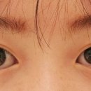 빛날-아이(eye)