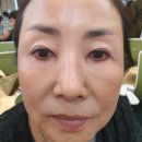 인셀덤순수