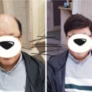 김호증모가발춘천체인점