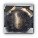 블랙스타 | 일산두피문신 전문 블랙스타스칼프 방문 후기