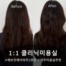 내가탑 2호점 | 헤르만헤어파주2호점 클리닉 후기 조용하고 세심했던 1대1 케어