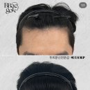 햇빛헤어라인 - 북구 | 햇빛헤어라인