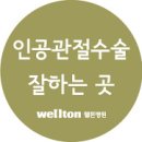 결우 이미지