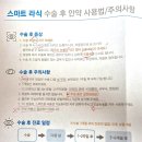 [🍀내돈내산⭐] 선릉 ㅊㄴㅇ 안과 스마트 라식 수술 당일 후기 (+상세한 수술 과정 묘사｜2일차 후기)