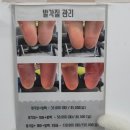 미소샵 - 의정부시 | 내돈내산 부산중구네일 여름 글리터 네일은 미소샵네일