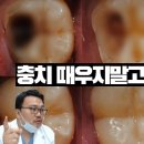 17년차 치과의사가 알려주는 치아재생 기술의 현주소. 이미지