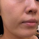 더스무스왁싱피부 군포점 네이버블로그