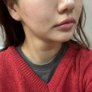 더생생한의원 | 강남안면비대칭교정 한의원 꼼꼼하게 다양한 치료받아본 2회차 생생 후기