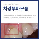 연세남구로치과의원 | 시린이의 불편함, 치약보다 치과치료를 받으세요 (구로치과)