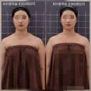 [전주 고아라컨투어샵] 전주얼굴경락 360도 회오리 전주윤곽관리 받은 후기! 전주윤곽관리 추천