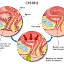 풀림한의원 이미지