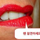 드롭샷