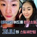 리얼스팀 | 블랙 헤드, 여드름 소멸!! 고니니 스팀 세안법 리얼후기