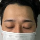 트윙클왁싱 이미지