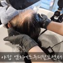 쌍용자동차 대덕서비스프라자 | 엠지에프두피탈모센터 야탑두피관리 솔직후기 (132개국 글로벌브랜드)