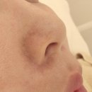 의정부 피부관리 뷰티다룸, 에그스킨플래닝 후기