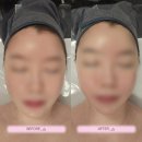 제이안 | [파주/운정 피부관리] V라인 완성! 제이안에스테틱 시그니처 작은얼굴 윤곽관리 후기