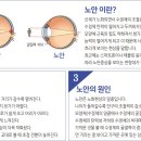 밝은누리안경 네이버블로그