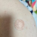 2026 HPV(자궁경부암) 예방접종 무료 대상자 총정리 | 남학생까지 확대된 이유