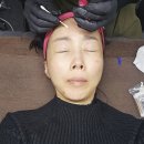 단미뷰티 | [남악피부관리] 단미뷰티 비립종 제거 솔직후기, 눈옆 비립종·남악문제성피부 관리 잘하는 곳