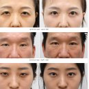 리미트성형외과의원 이미지