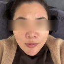 보나트페이스 이미지