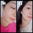 글림 - 성남시 분당구 벌장투리로 9 | 마시는 글루타치온 칼로비스 글림핑크 솔직후기