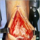 CW-0610-01 이미지