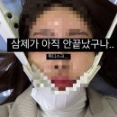 [ 강릉 한의원 ] 목디스크 침, 추나치료 후기:) 실비청구방법