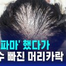 '셀프 파마' 했다가…우수수 빠진 머리카락 이미지