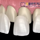 수복네일아트