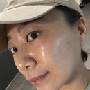 동래피부 | 동래에스테틱 동래피부관리 보아르에스테틱 솔직후기