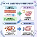 황인섭내과L-소아청소년과 | 다낭성난소증후군에 미오이노시톨, 호르몬제와 뭐가 다른가요?