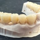 아치치과기공소 이미지