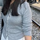 딩동멍 | 팔 람스 후기 (시술당일)