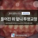 서울고운미소치과교정과치과의원 네이버블로그