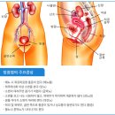 여성비뇨기과 뿌리부터 잡는 해결책 찾고싶다면 이미지