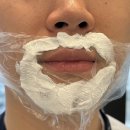 희앤 | [내돈내산] 강남 젠틀맥스프로플러스 남자수염 레이저제모 후기