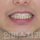인비스치과의원 이미지