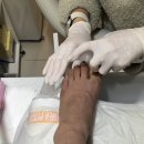 치유네일닥터아이티엔 | 경산내성발톱 치유네일 닥터아이티엔 문제성발톱 관리