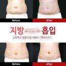 청담수여성의원 네이버블로그