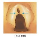 성대 이미지