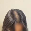 오오 | 신부관리 | SMP 두피문신 후기 (오오스튜디오) 신사smp, 신사두피관리