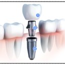 젠치과의원 이미지