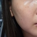 인천피부관리 송도에스테틱 키웰 인천송도점 옥시센스티브 송도피부관리 후기