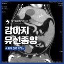 광주일곡병원 | 광주 일곡동물병원 강아지 유선종양 서혜부 림프절 수술 후기